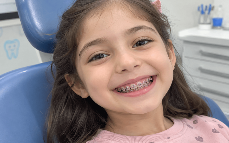 ارتودنسی ثابت تک فک